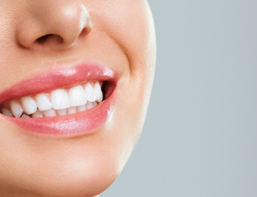 Whiter Teeth in Seconds